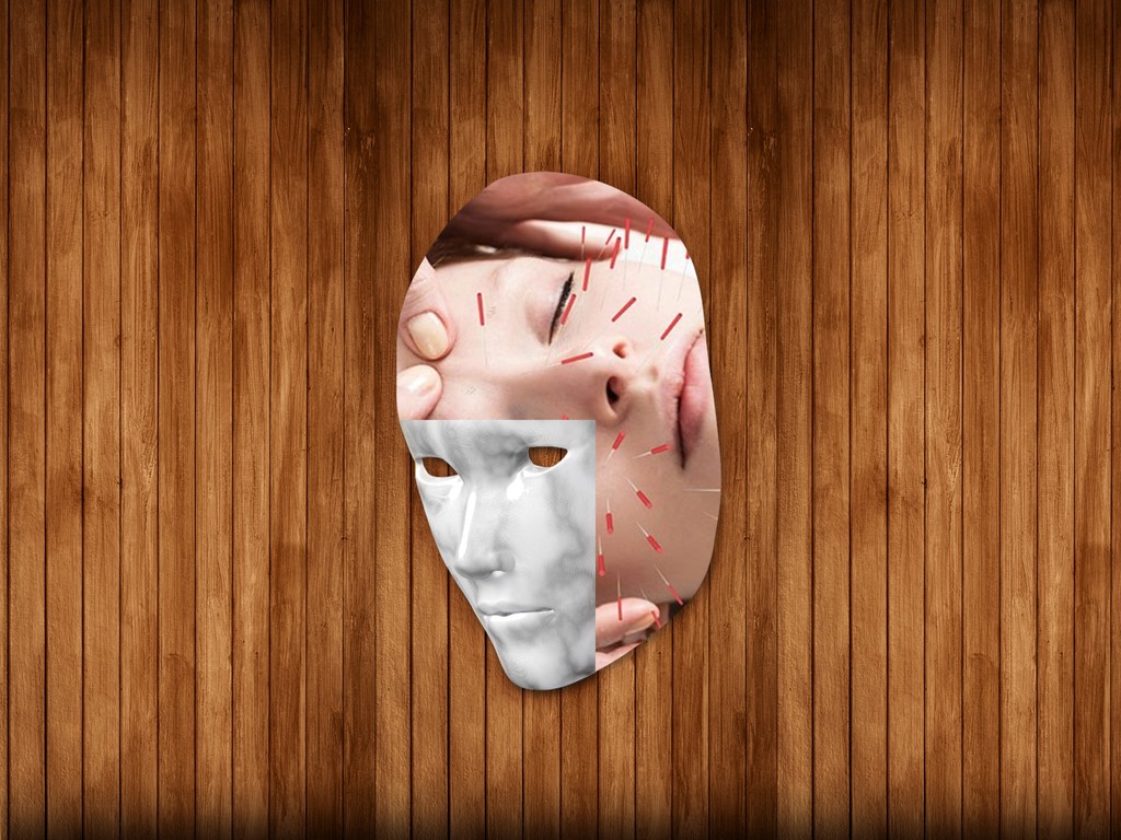 Dinamo Facefilters Acupuncture